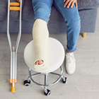 broken leg